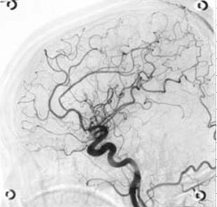 体内の血管が表示されている白黒の写真